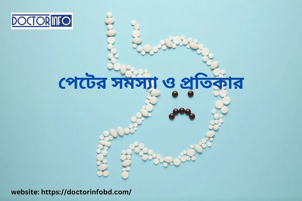 পেটের সমস্যা ও তার প্রতিকার | Doctor Info BD