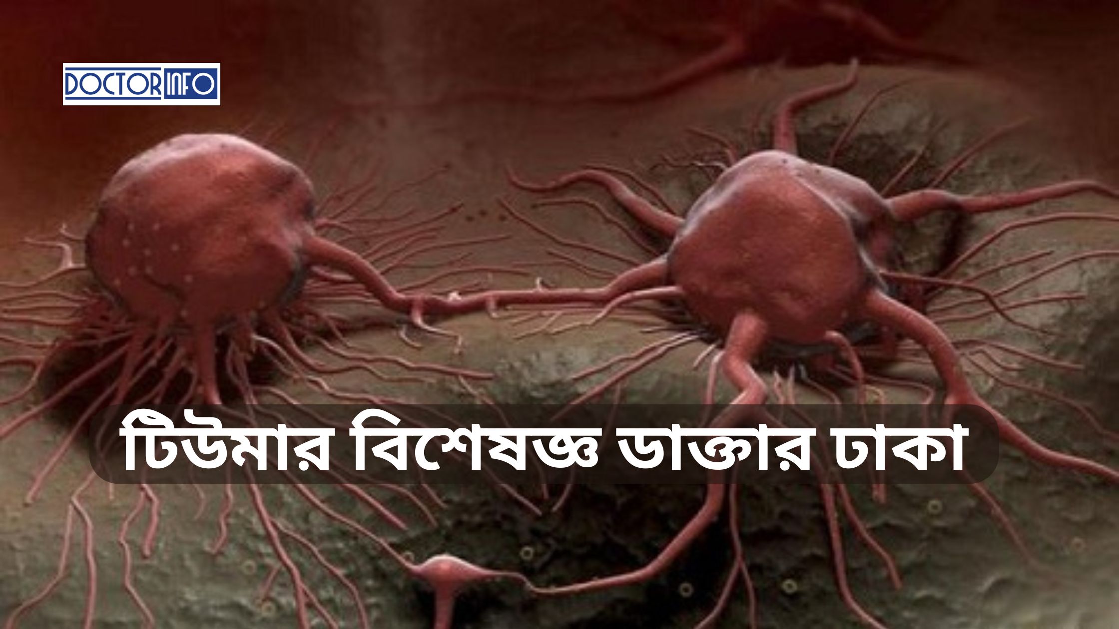 টিউমার বিশেষজ্ঞ ডাক্তার ঢাকা ও তাদের সেরা পরামর্শ