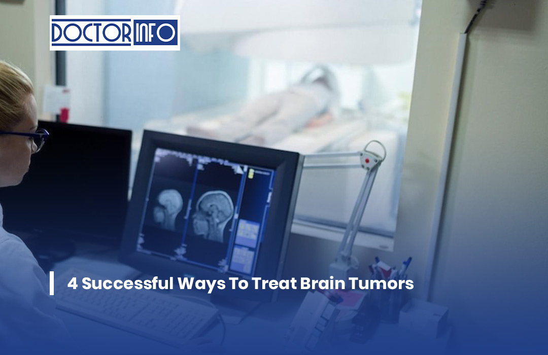 4 Successful Ways To Treat Brain Tumors