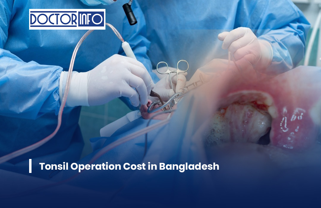 Tonsil Operation Cost in Bangladesh