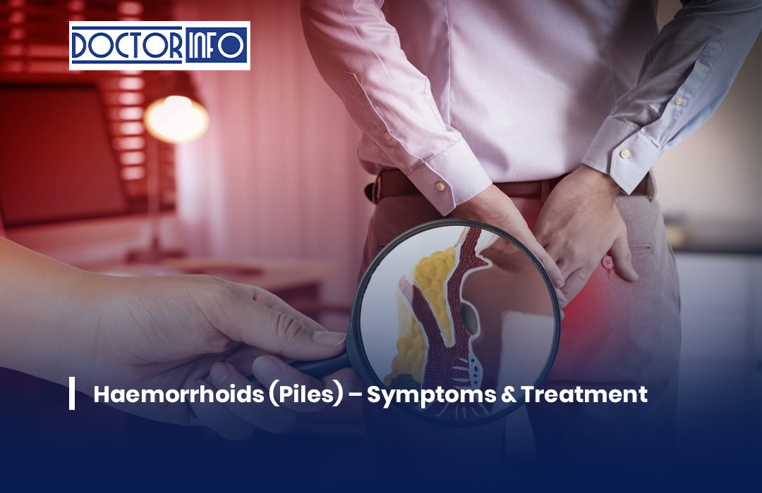 Haemorrhoids (Piles) – Symptoms & Treatment