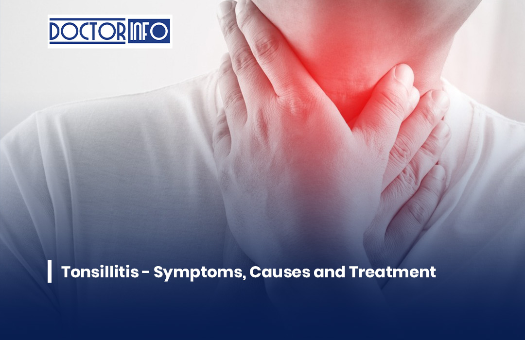 Tonsillitis - Symptoms, Causes and Treatment