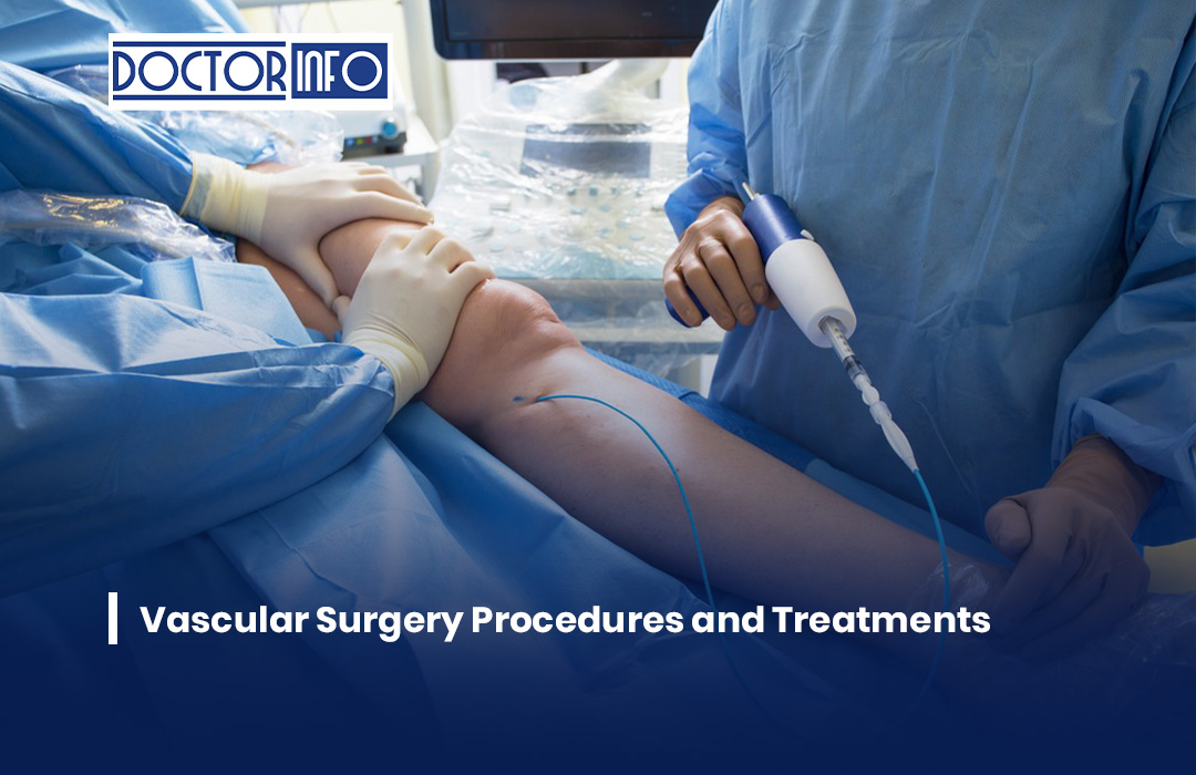 Vascular Surgery Procedures and Treatments