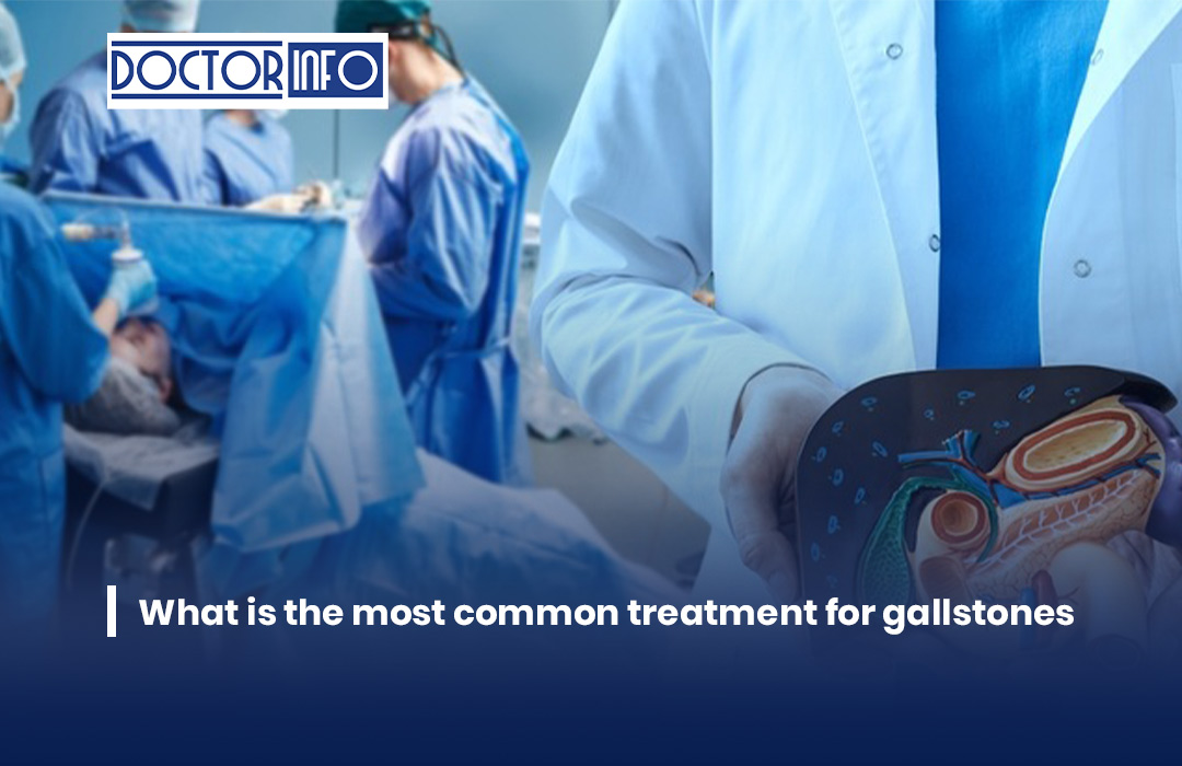 What is the most common treatment for gallstones