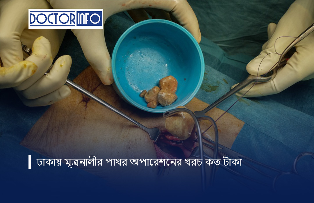ঢাকায় মূত্রনালীর পাথর অপারেশনের খরচ কত টাকা