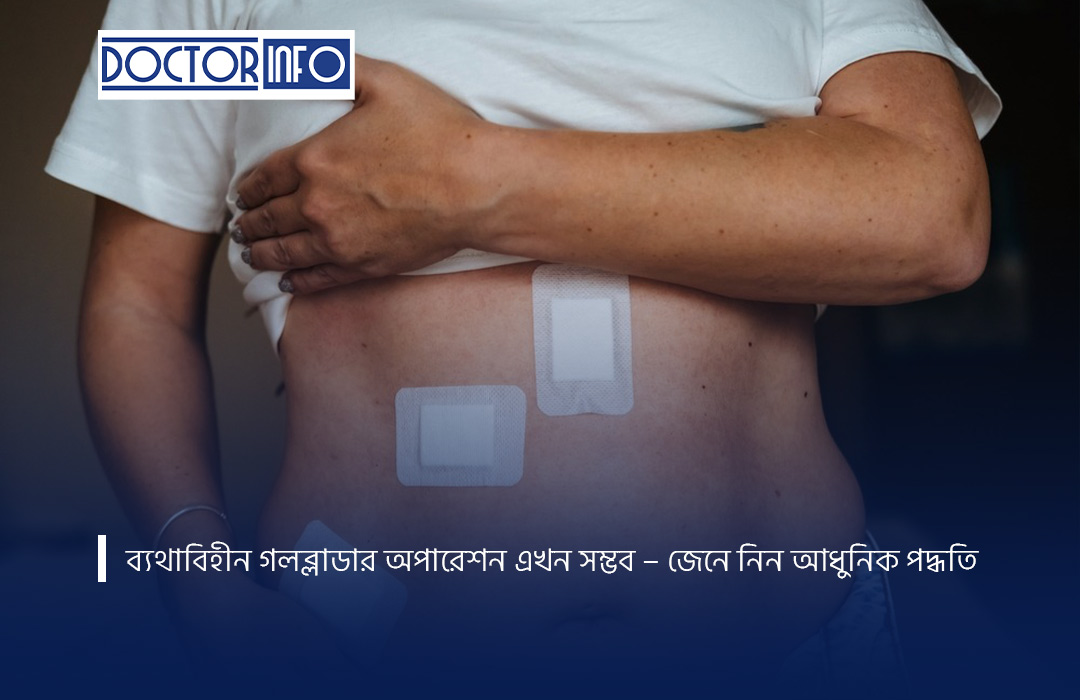 ব্যথাবিহীন গলব্লাডার অপারেশন এখন সম্ভব – জেনে নিন আধুনিক পদ্ধতি