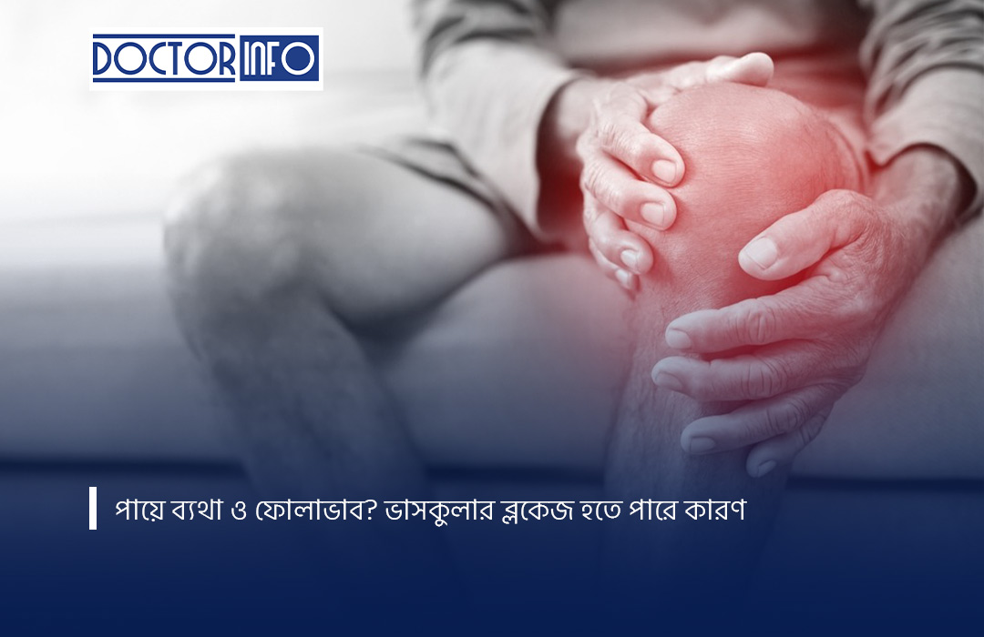 পায়ে ব্যথা ও ফোলাভাব? ভাসকুলার ব্লকেজ হতে পারে কারণ