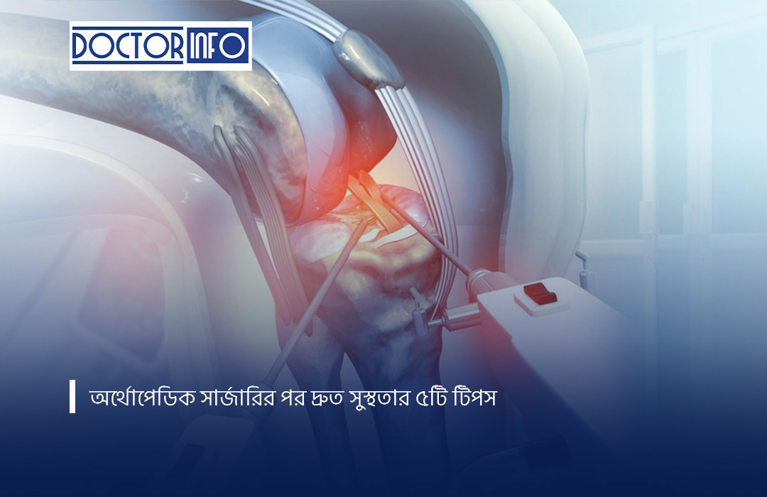অর্থোপেডিক সার্জারির পর দ্রুত সুস্থতার ৫টি টিপস