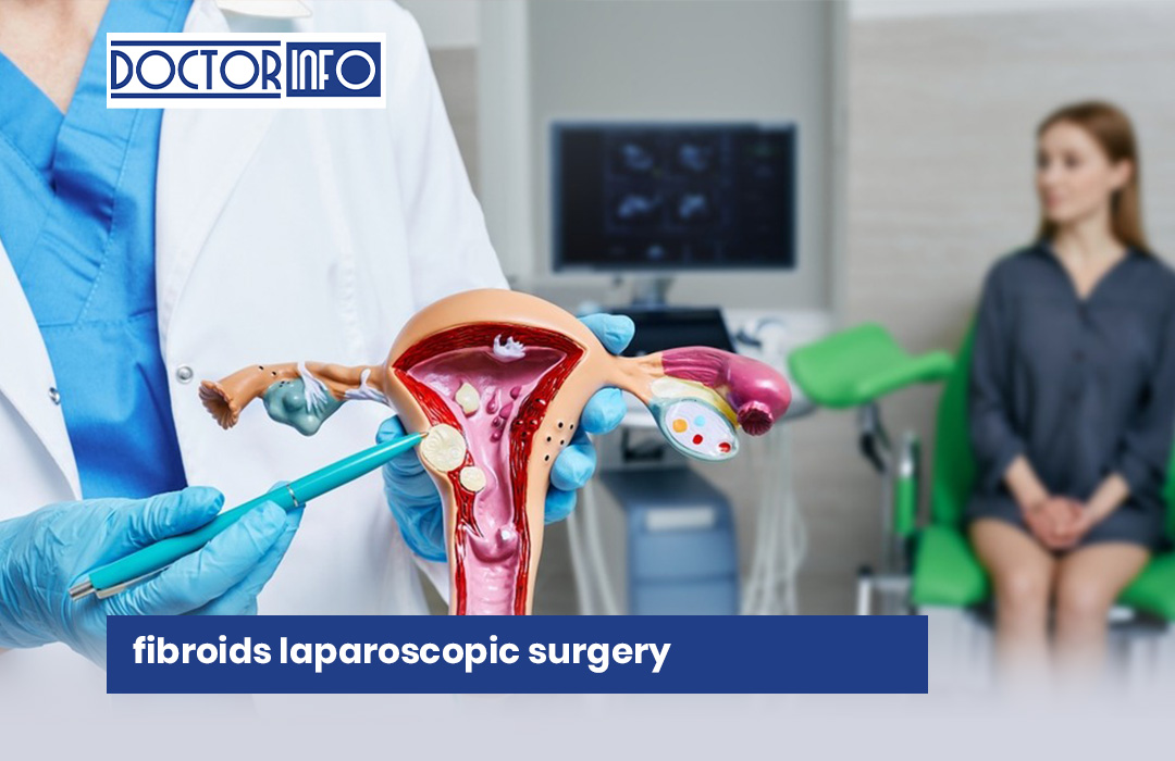 Fibroids Laparoscopic Surgery in Dhaka