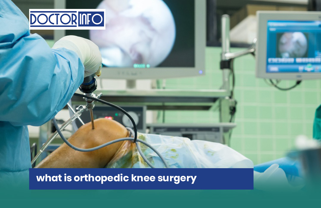 What is Orthopedic Knee Surgery