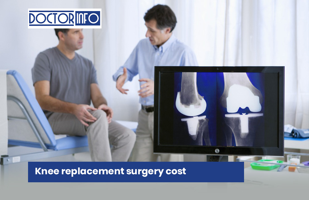 Knee Replacement Surgery Cost