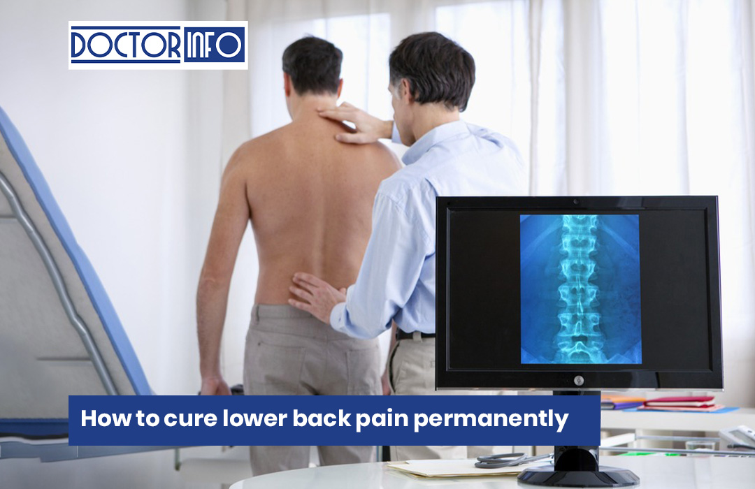 How to Cure Lower Back Pain Permanently