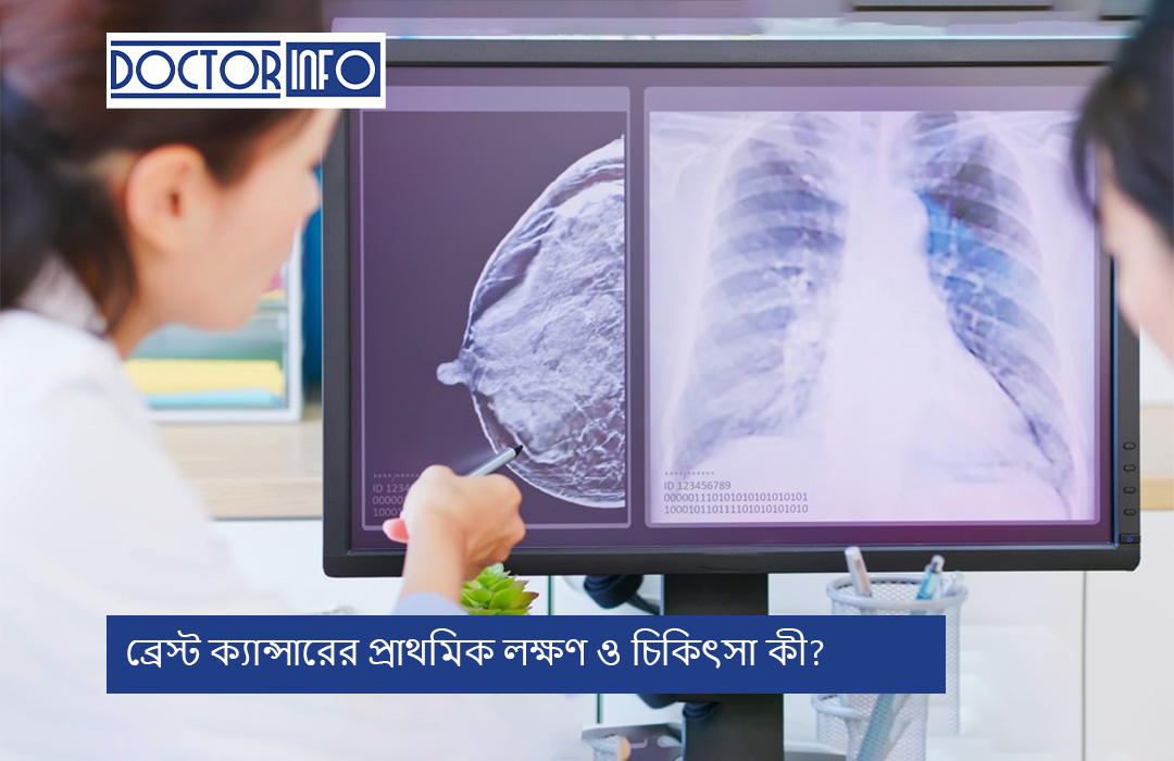 ব্রেস্ট ক্যান্সারের প্রাথমিক লক্ষণ ও চিকিৎসা কী?