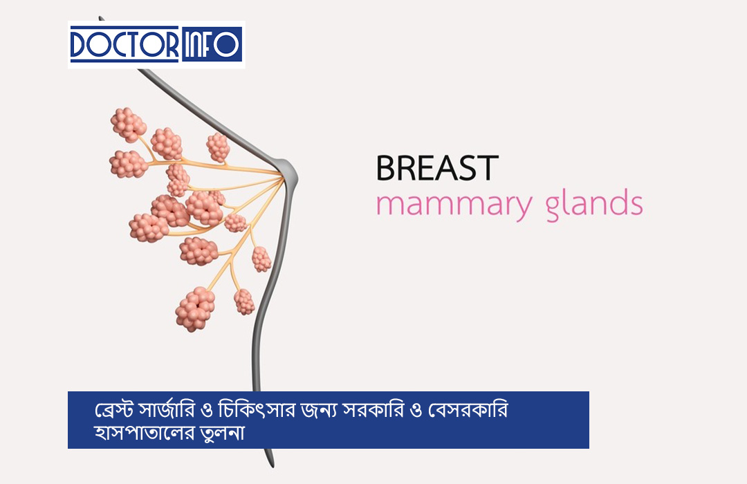 ব্রেস্ট সার্জারি ও চিকিৎসার জন্য সরকারি ও বেসরকারি হাসপাতালের তুলনা