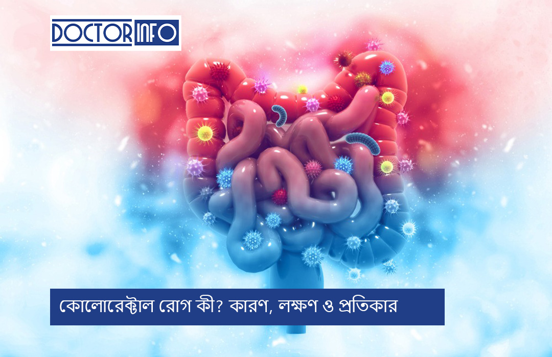কোলোরেক্টাল রোগ কী? কারণ, লক্ষণ ও প্রতিকার