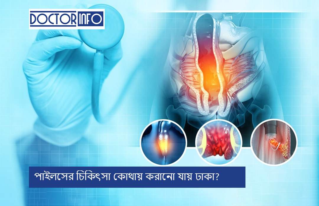 পাইলসের চিকিৎসা কোথায় করানো যায় ঢাকা?