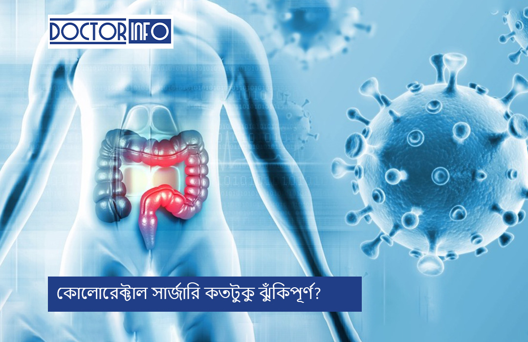 কোলোরেক্টাল সার্জারি কতটুকু ঝুঁকিপূর্ণ?