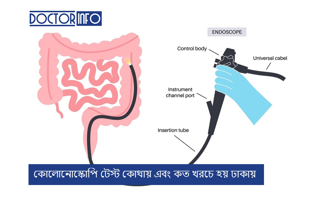 কোলোনোস্কোপি টেস্ট কোথায় এবং কত খরচে হয় ঢাকায়