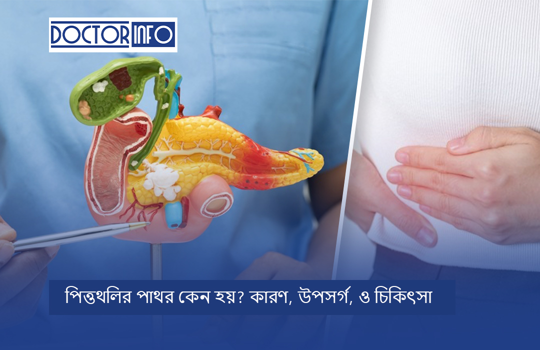 পিত্তথলির পাথর কেন হয়? কারণ, উপসর্গ, ও চিকিৎসা
