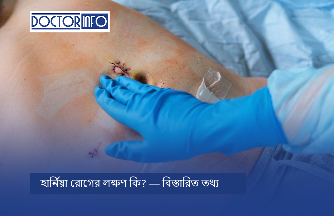 হার্নিয়া রোগের লক্ষণ কি? — বিস্তারিত তথ্য