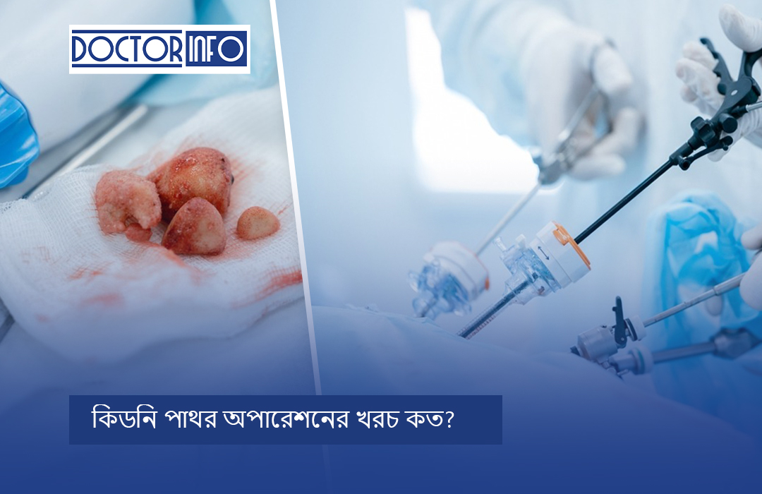 কিডনি পাথর অপারেশনের খরচ কত?